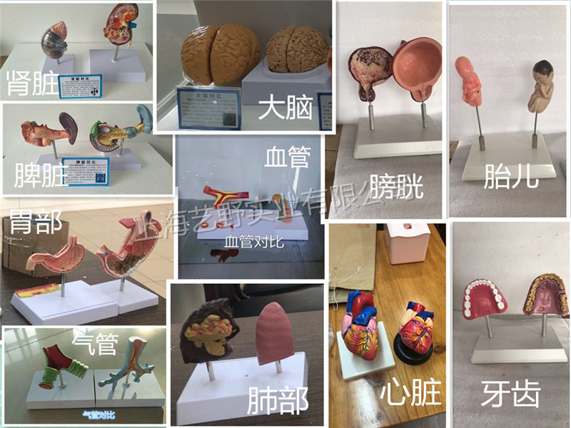 器官對比