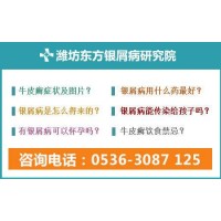 濰坊看銀屑病專(zhuān)業(yè)的公立醫(yī)院