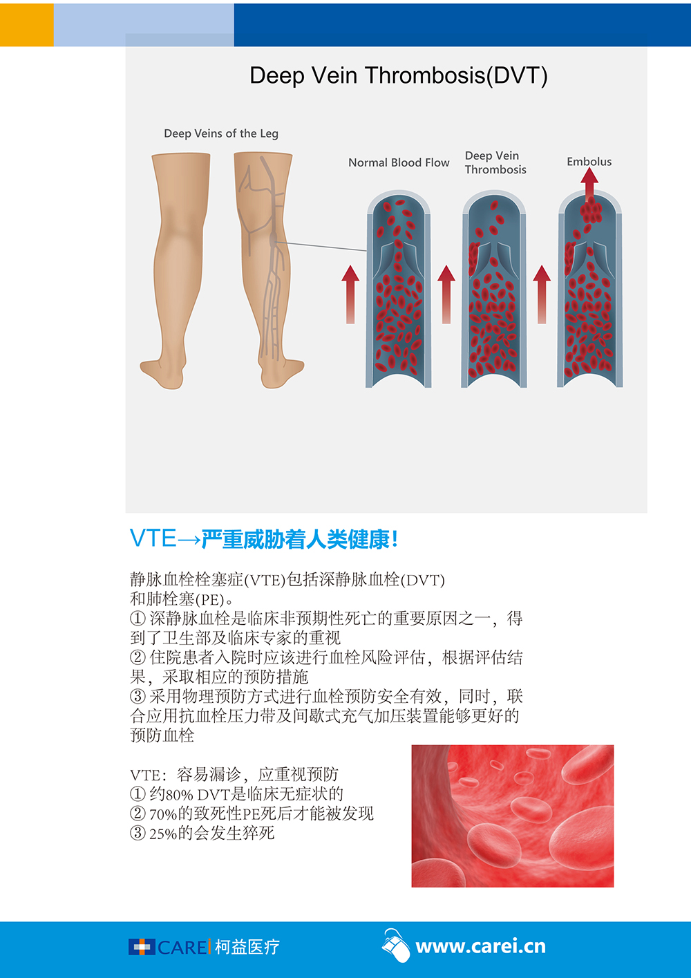 1578992158238306.jpg VenaFlow Elite System-f4.jpg