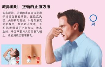 流鼻血怎么能快速止血，鼻出血的正確止血方法